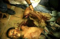 palestinian_child_armcutoff-holocaust.jpg
